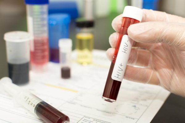 hiv-test-tube