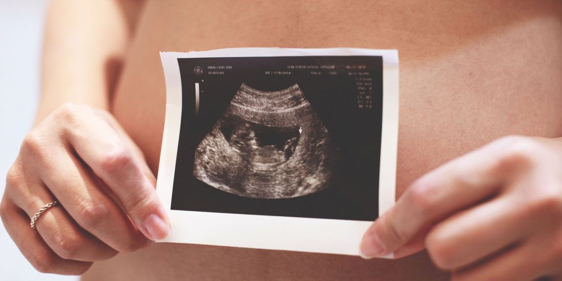 Avortement : les retombées de la décision de la Cour suprême américaine