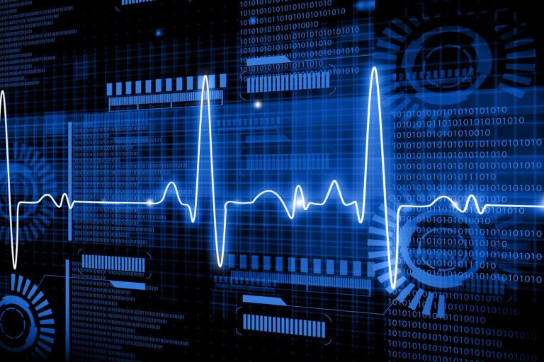Intelligence artificielle : détection des crises cardiaques avec cinq ans d’avance