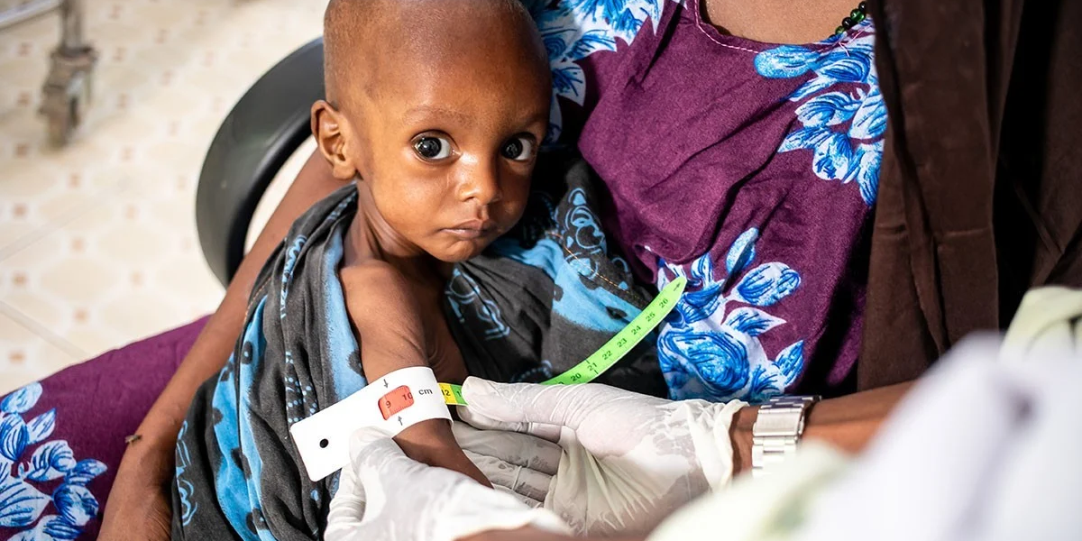 Somalie : 386.000 enfants souffrent de malnutrition, selon l’Unicef